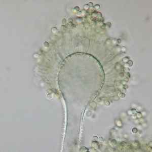 Aspergillus-flavus